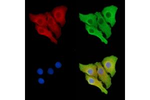ABIN6264421 and ABIN6278673 staining Hela cells by IF/ICC.