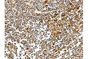 The image on the left is immunohistochemistry of paraffin-embedded Human tonsil tissue using ABIN7128894(CEACAM21 Antibody) at dilution 1/60, on the right is treated with fusion protein. (CEACAM21 antibody)