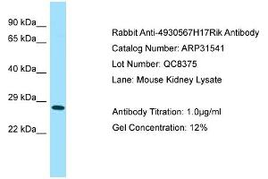 WB Suggested Anti-4930567H17Rik Antibody   Titration: 1. (4930567H17Rik antibody  (Middle Region))