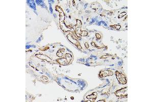 Immunohistochemistry (IHC) image for anti-CD34 (CD34) (C-Term) antibody (ABIN6138169)