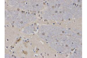 Immunohistochemistry (IHC) image for anti-Calcium/calmodulin-Dependent serine Protein Kinase (MAGUK Family) (CASK) antibody (ABIN1871447) (CASK antibody)