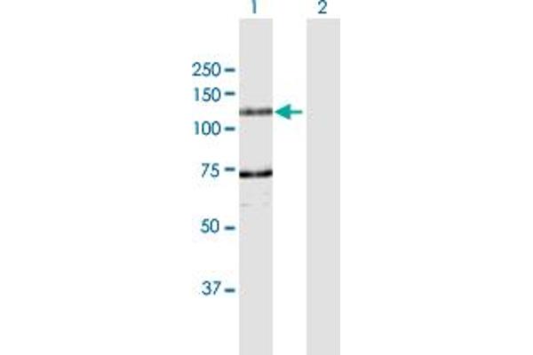 DDHD1 anticorps  (AA 1-872)