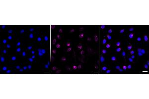 anti-Homeobox A9 (HOXA9) antibody