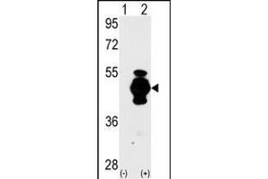 Western blot analysis of GF (arrow) using GF Antibody (N-term) 2017a. (GFAP antibody  (N-Term))