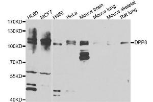 Western blot analysis of extracts of various cell lines, using DPP8 antibody. (DPP8 antibody)