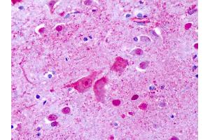 Anti-GPR137 antibody IHC of human brain, cortex, cerebellum. (GPR137 antibody  (Cytoplasmic Domain))