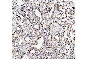 anti-Suppressor of Cytokine Signaling 5 (SOCS5) (AA 386-536) antibody