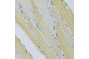 Immunohistochemistry of paraffin-embedded mouse skeletal muscle using CXCR3 Antibody. (CXCR3 antibody)