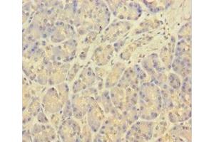 Immunohistochemistry of paraffin-embedded human pancreatic tissue using ABIN7146334 at dilution of 1:100 (KCNMA1 antibody  (AA 1-86))