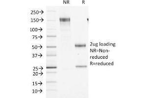 SDS-PAGE (SDS) image for anti-Coagulation Factor XIII, A1 Polypeptide (F13A1) (AA 46-181) antibody (ABIN6939361)