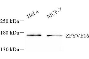 Western blot analysis of ZFYVE16 (ABIN7076283) at dilution of 1: 500 (ZFYVE16 antibody)