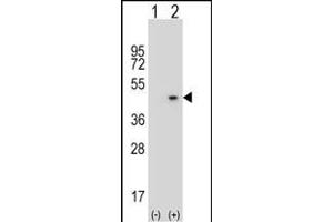 Western blot analysis of AZGP1 (arrow) using rabbit polyclonal AZGP1 Antibody (N-term) (ABIN390565 and ABIN2840895). (AZGP1 antibody  (N-Term))