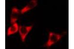 ABIN6274275 staining HeLa cells by IF/ICC.
