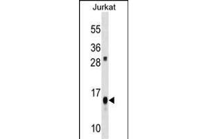 ATP5D Antibody (C-term) (ABIN1536694 and ABIN2848523) western blot analysis in Jurkat cell line lysates (35 μg/lane). (ATP5F1D antibody  (C-Term))