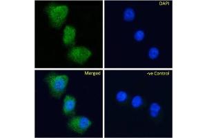 Immunofluoresence staining of fixed MDA-MB-231 cells with anti-Glucose-dependent insulinotropic receptor antibody Gipg013.