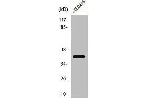 Western Blot analysis of COLO205 cells using GPR62 Polyclonal Antibody (GPR62 antibody  (Internal Region))