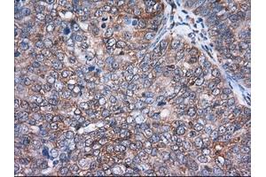 Immunohistochemical staining of paraffin-embedded Human Kidney tissue using anti-ACAT2 mouse monoclonal antibody.