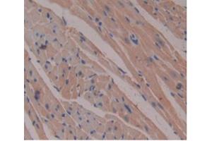 Immunohistochemistry (IHC) image for anti-beta-2-Microglobulin (B2M) (AA 22-119) antibody (ABIN7427840)