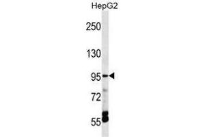TRPV5 Antibody (C-term) western blot analysis in HepG2 cell line lysates (35 µg/lane). (TRPV5 antibody  (C-Term))