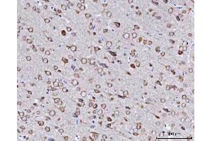 IHC analysis of BBS9 using anti-BBS9 antibody (ABIN7601518). (BBS9 antibody  (AA 37-793))