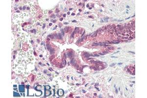 ABIN571231 (10µg/ml) staining of paraffin embedded Human Lung. (PSMB3 antibody  (Internal Region))