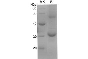 Western Blotting (WB) image for Kallikrein 6 (KLK6) protein (His tag) (ABIN7321290) (Kallikrein 6 Protein (KLK6) (His tag))