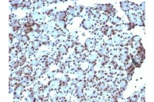 Immunohistochemistry (Formalin-fixed Paraffin-embedded Sections) (IHC (fp)) image for anti-Small Ubiquitin Related Modifier Protein 1 (SUMO1) antibody (ABIN3026864)