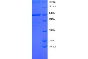 Sorting Nexin 3 (SNX3) (AA 3-162), (full length) protein (GST tag) (Sorting Nexin 3 Protein (SNX3) (AA 3-162, full length) (GST tag))
