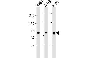 All lanes : Anti-PLA2G4D Antibody (C-Term) at 1:2000 dilution Lane 1: A431 whole cell lysate Lane 2: A549 whole cell lysate Lane 3: Hela whole cell lysate Lysates/proteins at 20 μg per lane. (PLA2G4D antibody  (AA 754-786))