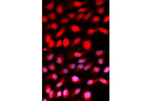Immunofluorescence analysis of U2OS cells using ZEB1 antibody (ABIN5973261).