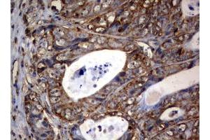 Image no. 3 for anti-3-Oxoacyl-ACP Synthase, Mitochondrial (OXSM) (AA 78-343) antibody (ABIN1491676) (OXSM antibody  (AA 78-343))