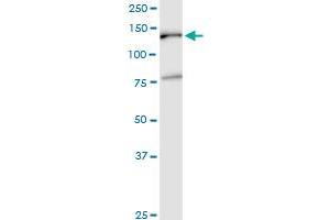 EMILIN2 monoclonal antibody (M01), clone 3D9. (EMILIN2 antibody  (AA 121-230))