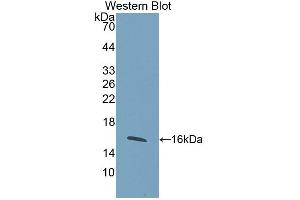 Western blot analysis of the recombinant protein. (WISP1 antibody  (AA 216-347))