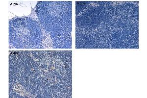 Immunohistochemistry (IHC) image for anti-Interleukin 6 (IL6) antibody (ABIN964746)