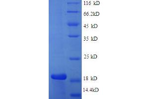 SDS-PAGE (SDS) image for Caspase 3 (CASP3) (AA 29-175), (partial) protein (His tag) (ABIN5712415) (Caspase 3 Protein (CASP3) (AA 29-175, partial) (His tag))
