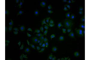Immunofluorescence staining of A549 cells with ABIN7148235 at 1:100, counter-stained with DAPI. (COL18A1 antibody  (AA 1600-1754))