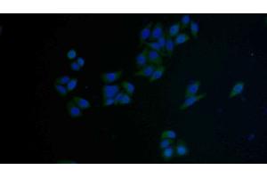 Detection of FAS in Human MCF7 cell using Polyclonal Antibody to Factor Related Apoptosis (FAS) (FAS antibody  (AA 22-169))