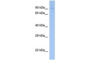 Image no. 1 for anti-Feline Sarcoma Oncogene (FES) (AA 28-77) antibody (ABIN6748278) (FES antibody  (AA 28-77))