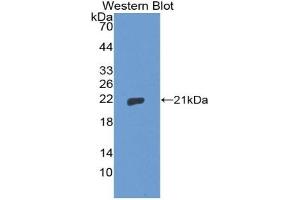 Detection of Recombinant THOP1, Human using Polyclonal Antibody to Thimet Oligopeptidase 1 (THOP1) (Thimet Oligopeptidase 1 antibody  (AA 451-597))