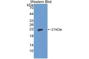 Detection of Recombinant THOP1, Human using Polyclonal Antibody to Thimet Oligopeptidase 1 (THOP1) (Thimet Oligopeptidase 1 antibody  (AA 451-597))
