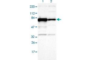 Western blot analysis of Lane 1: Human cell line RT-4 Lane 2: Human cell line U-251MG sp with OPTN polyclonal antibody  at 1:100-1:250 dilution. (OPTN antibody)