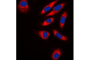 Immunofluorescent analysis of TRAF3IP1 staining in HeLa cells. (TRAF3IP1 antibody  (Center))