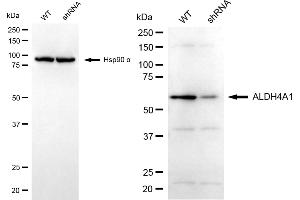 Western blotting analysis using ALDH4A1 antibody (ABIN7797566).