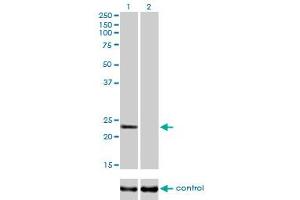 Western blot analysis of RAB9A over-expressed 293 cell line, cotransfected with RAB9A Validated Chimera RNAi (Lane 2) or non-transfected control (Lane 1).