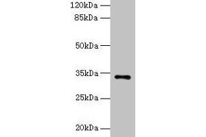 Western blot All lanes: NAT2 antibody at 6 μg/mL + Mouse brain tissue Secondary Goat polyclonal to rabbit IgG at 1/10000 dilution Predicted band size: 34 kDa Observed band size: 34 kDa (NAT2 antibody  (AA 1-290))