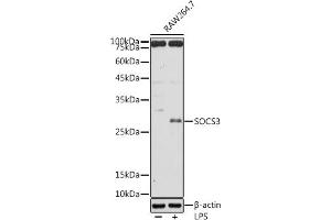 Western blot analysis of extracts of R. (SOCS3 antibody  (C-Term))