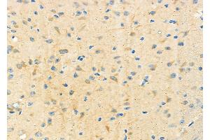 ABIN6265743 and ABIN6273181 at 1/100 staining Mouse brain tissue by IHC-P. (TRIM9 antibody  (N-Term))