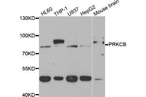 Western blot analysis of extracts of various cell lines, using PRKCB antibody (ABIN5973456) at 1/1000 dilution. (PKC beta antibody)