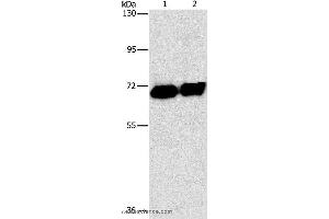 Western blot analysis of HepG2 cell and human placenta tissue, using ALPP Polyclonal Antibody at dilution of 1:1550 (PLAP antibody)
