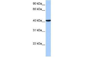 CC2D1B antibody used at 1 ug/ml to detect target protein.
